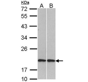 Cofilin 2 antibody from Signalway Antibody (22617) - Antibodies.com