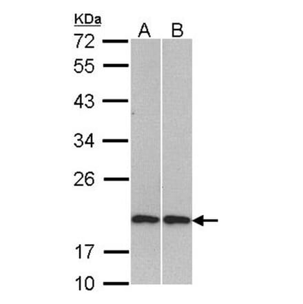 Cofilin 2 antibody from Signalway Antibody (22617) - Antibodies.com