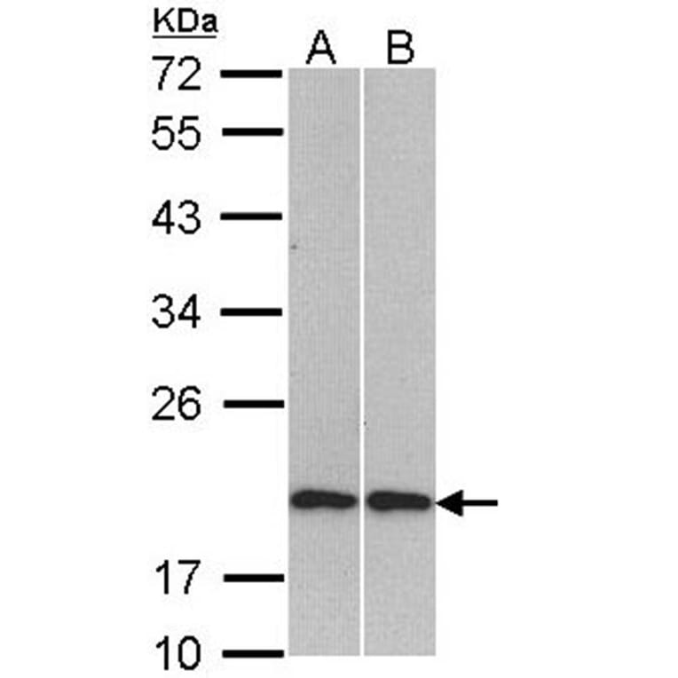 Cofilin 2 antibody from Signalway Antibody (22617) - Antibodies.com