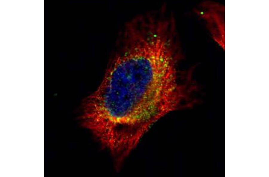 Cofilin 2 antibody from Signalway Antibody (22617) - Antibodies.com