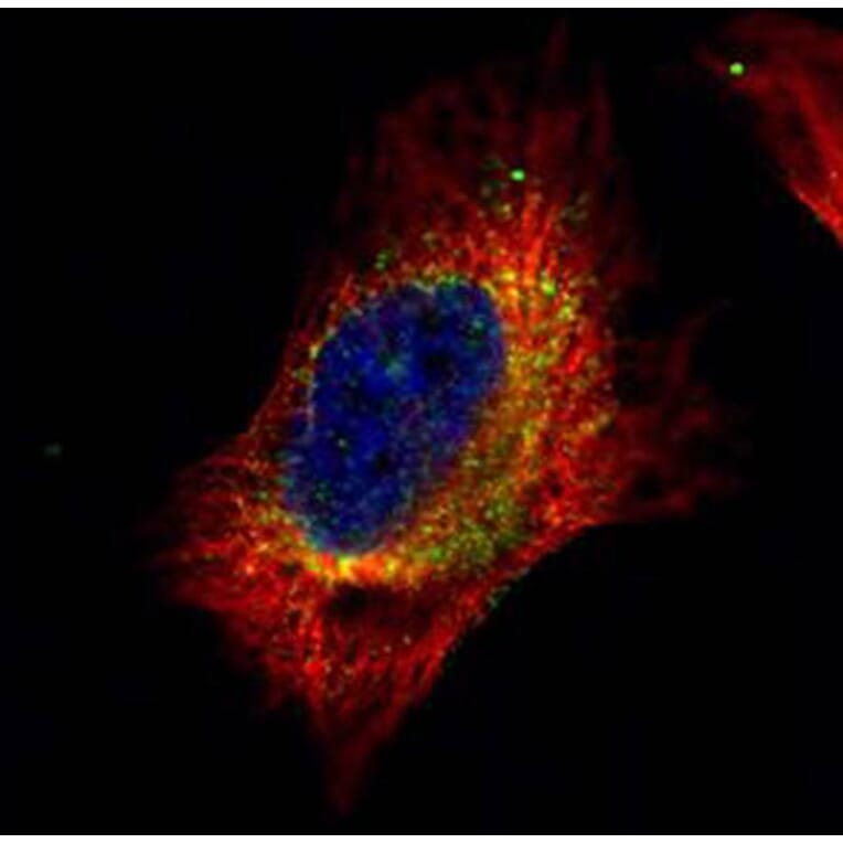 Cofilin 2 antibody from Signalway Antibody (22617) - Antibodies.com