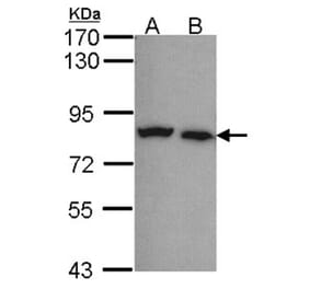 Calpain-5 antibody from Signalway Antibody (22799) - Antibodies.com