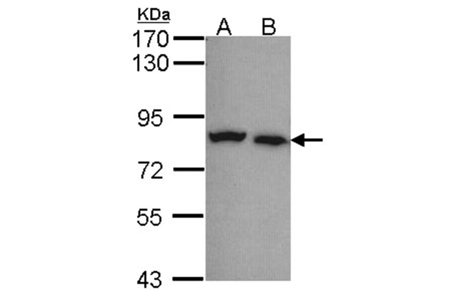 Calpain-5 antibody from Signalway Antibody (22799) - Antibodies.com