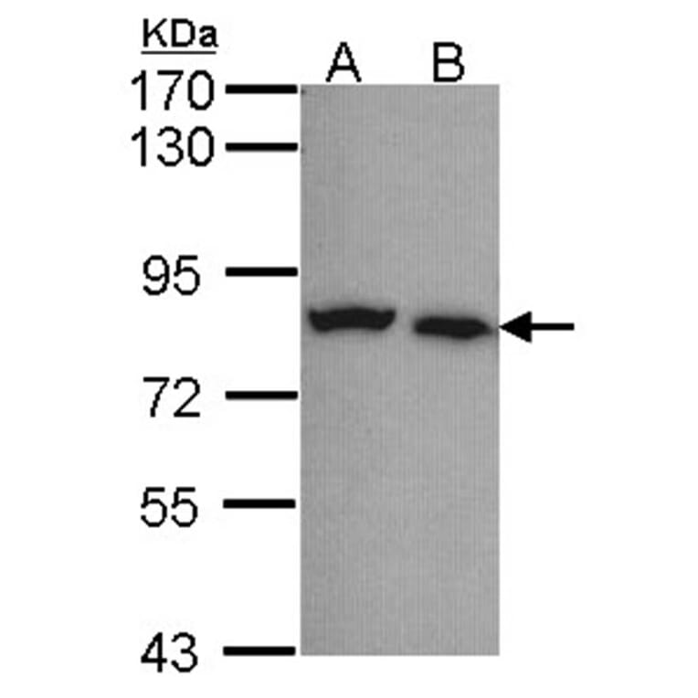 Calpain-5 antibody from Signalway Antibody (22799) - Antibodies.com