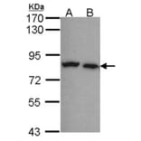 Calpain-5 antibody from Signalway Antibody (22799) - Antibodies.com