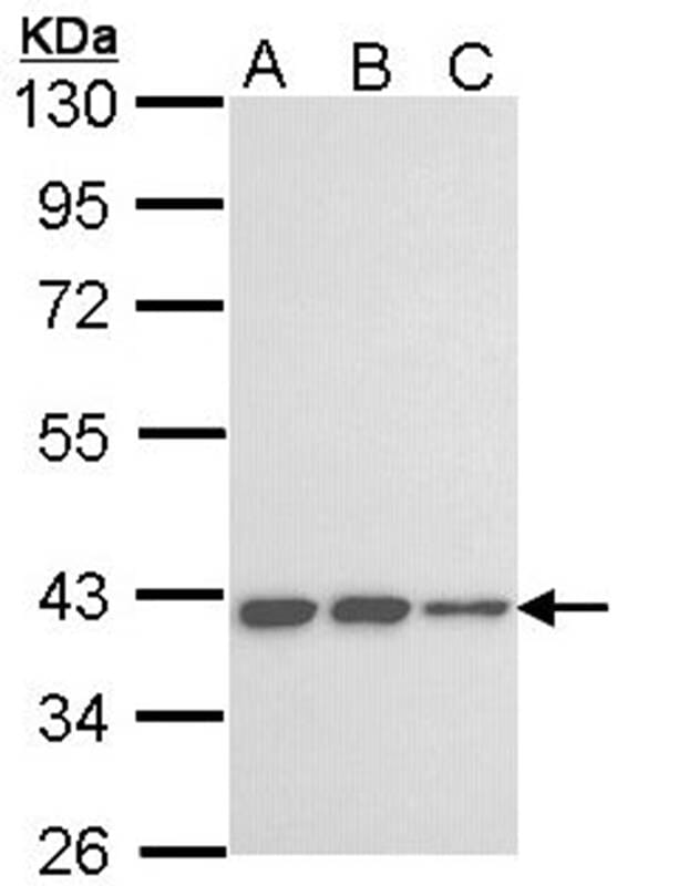 Sample (30 µg of whole cell lysate)  A431 B: H1299 C: Hela 10% SDS PAGE Primary antibody diluted at 1: 1000