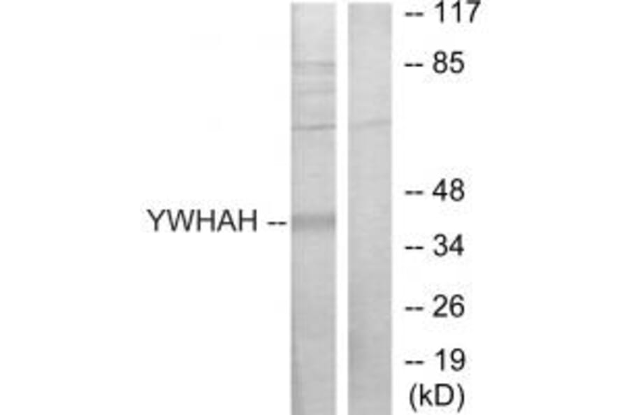 Western blot - 14-3-3 η Antibody from Signalway Antibody (34146) - Antibodies.com