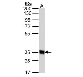 G protein-coupled receptor 62 antibody from Signalway Antibody (22828) - Antibodies.com