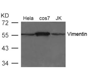 Western blot - Vimentin Antibody from Signalway Antibody (21488) - Antibodies.com