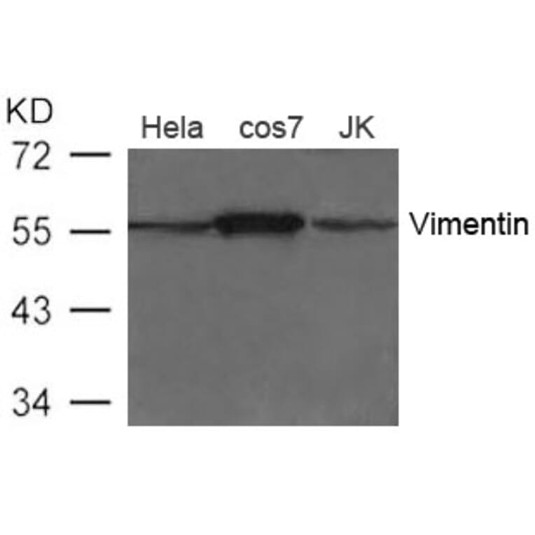 Western blot - Vimentin Antibody from Signalway Antibody (21488) - Antibodies.com