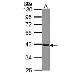hnRNP E2 antibody from Signalway Antibody (22168) - Antibodies.com