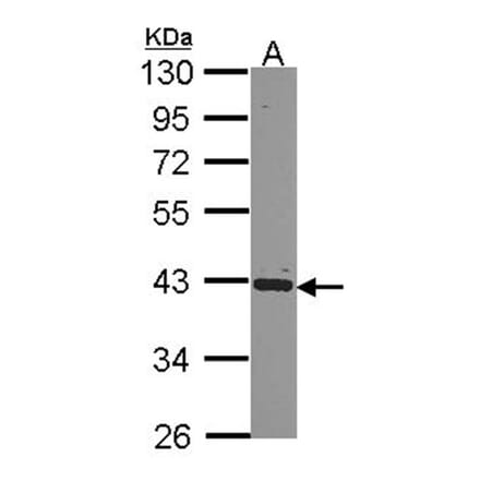 hnRNP E2 antibody from Signalway Antibody (22168) - Antibodies.com