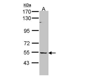 BAIAP2L1 antibody from Signalway Antibody (22232) - Antibodies.com