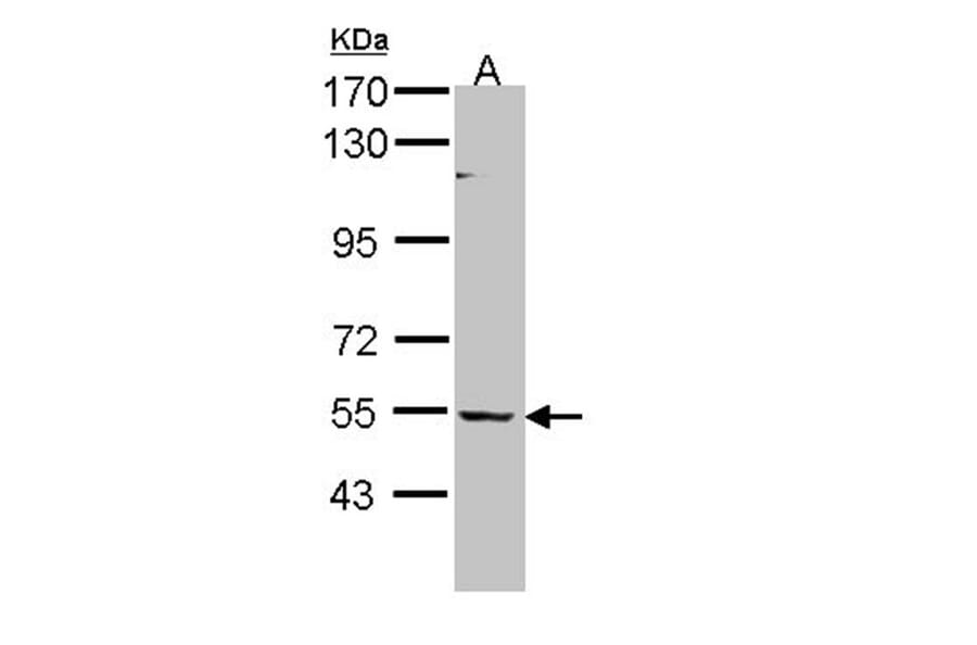BAIAP2L1 antibody from Signalway Antibody (22232) - Antibodies.com