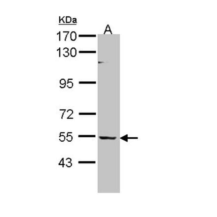 BAIAP2L1 antibody from Signalway Antibody (22232) - Antibodies.com