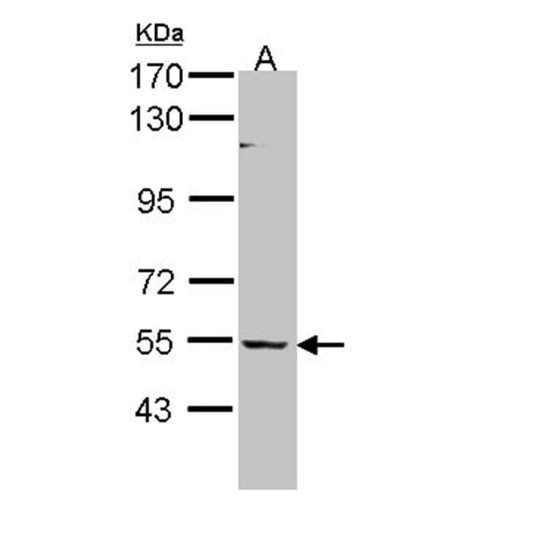 BAIAP2L1 antibody from Signalway Antibody (22232) - Antibodies.com