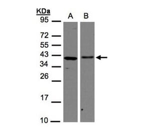 EMAP II antibody from Signalway Antibody (22440) - Antibodies.com