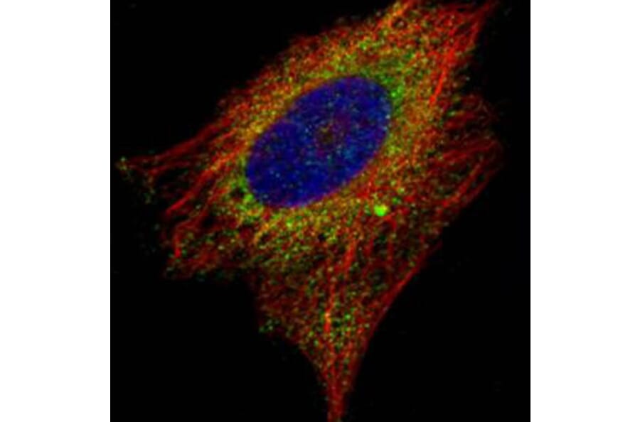 EMAP II antibody from Signalway Antibody (22440) - Antibodies.com