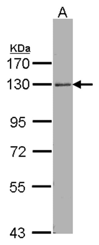Sample (30 µg of whole cell lysate)  Hep G2 7.5% SDS PAGE Primary antibody diluted at 1: 1000