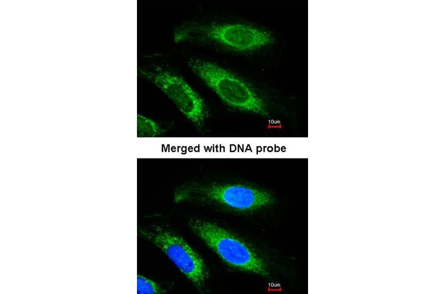Immunofluorescence - Beta-ETF antibody from Signalway Antibody (22670) - Antibodies.com