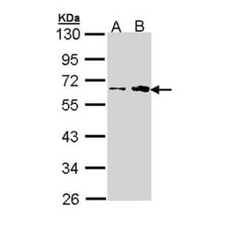 fukutin antibody from Signalway Antibody (22996) - Antibodies.com