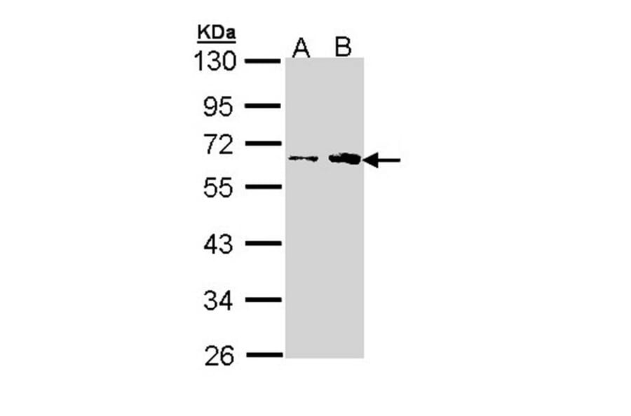 fukutin antibody from Signalway Antibody (22996) - Antibodies.com