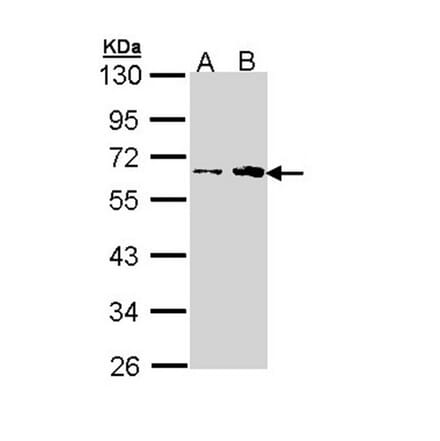 fukutin antibody from Signalway Antibody (22996) - Antibodies.com