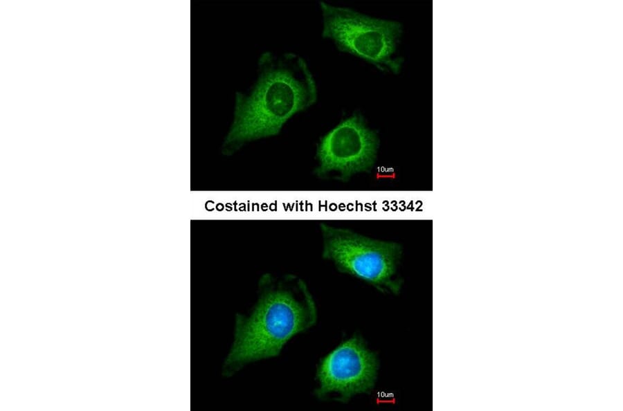 Immunofluorescence - fukutin antibody from Signalway Antibody (22996) - Antibodies.com
