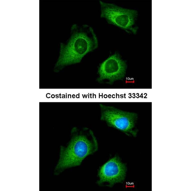 Immunofluorescence - fukutin antibody from Signalway Antibody (22996) - Antibodies.com
