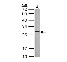 HLA-DRB3 antibody from Signalway Antibody (23014) - Antibodies.com