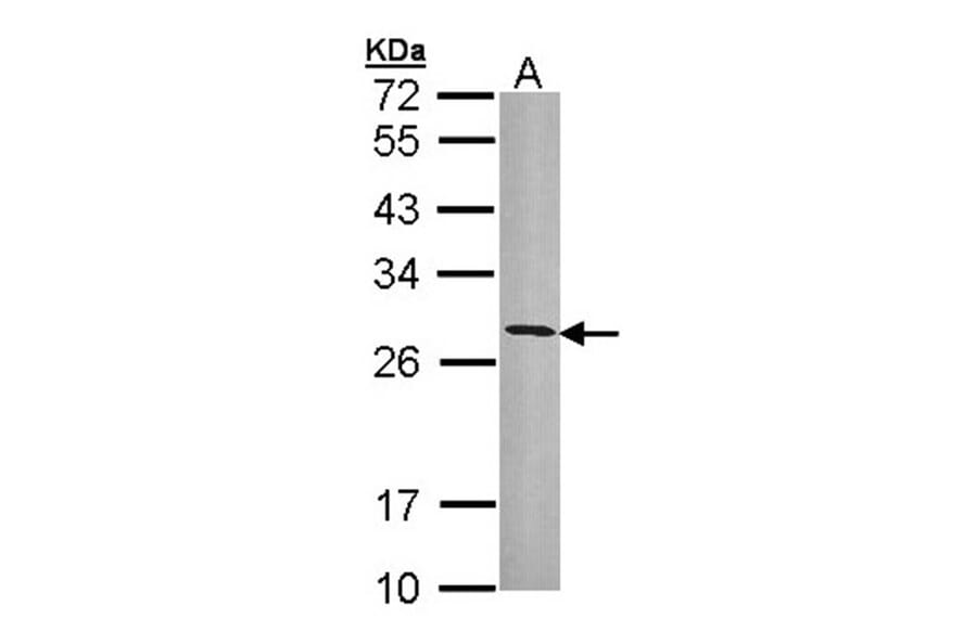 HLA-DRB3 antibody from Signalway Antibody (23014) - Antibodies.com