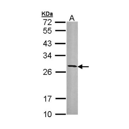 HLA-DRB3 antibody from Signalway Antibody (23014) - Antibodies.com