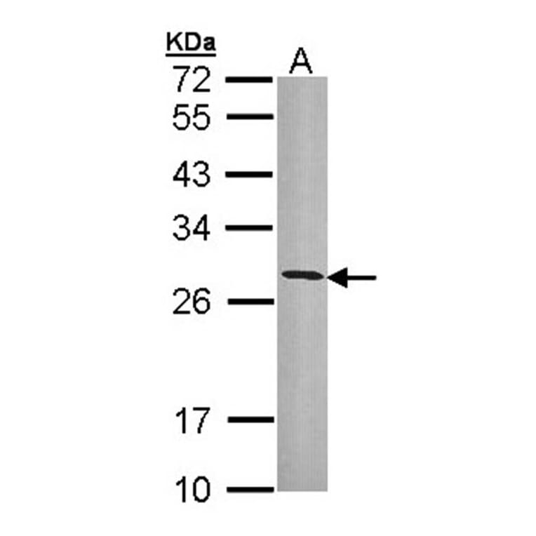 HLA-DRB3 antibody from Signalway Antibody (23014) - Antibodies.com