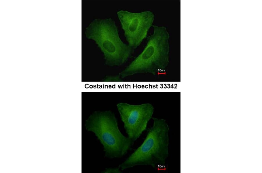 Immunofluorescence - HLA-DRB3 antibody from Signalway Antibody (23014) - Antibodies.com