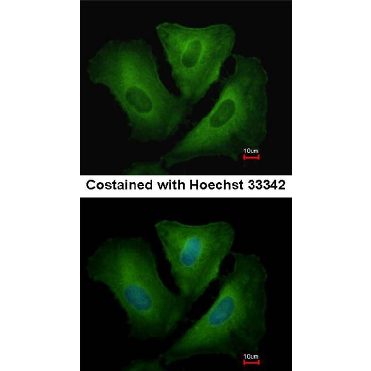 Immunofluorescence - HLA-DRB3 antibody from Signalway Antibody (23014) - Antibodies.com