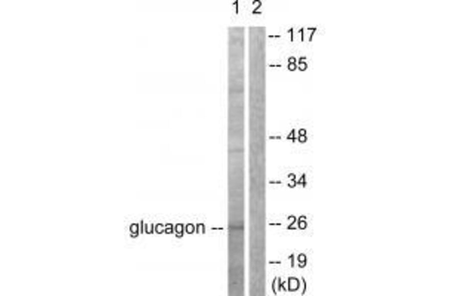 Western blot - Glucagon Antibody from Signalway Antibody (33385) - Antibodies.com