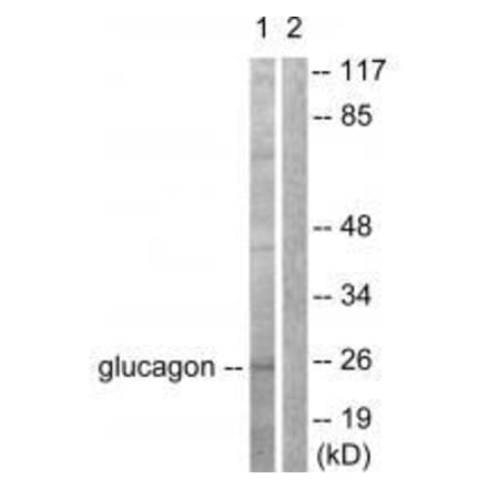 Western blot - Glucagon Antibody from Signalway Antibody (33385) - Antibodies.com