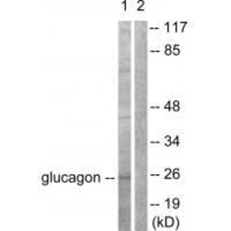 Western blot - Glucagon Antibody from Signalway Antibody (33385) - Antibodies.com