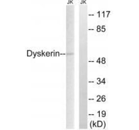 Western blot - Dyskerin Antibody from Signalway Antibody (33605) - Antibodies.com