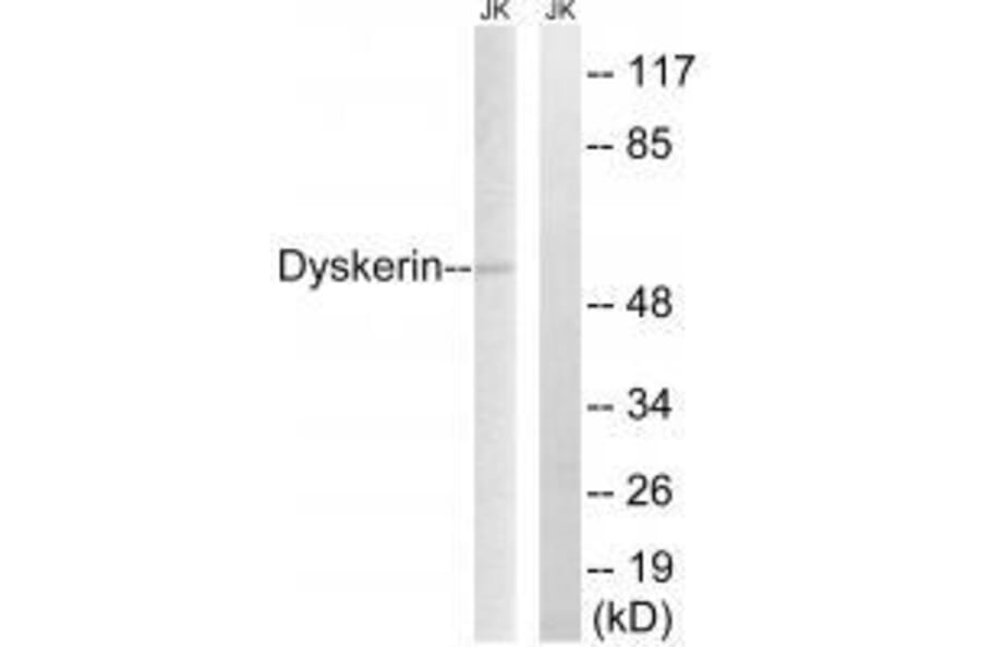 Western blot - Dyskerin Antibody from Signalway Antibody (33605) - Antibodies.com