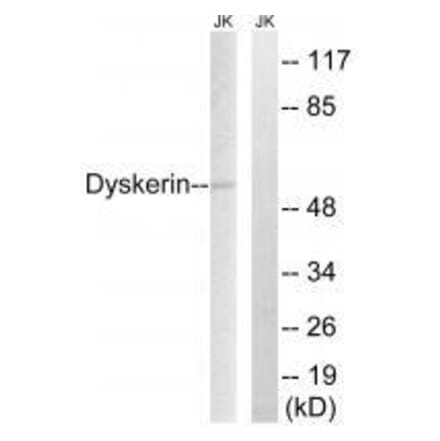 Western blot - Dyskerin Antibody from Signalway Antibody (33605) - Antibodies.com