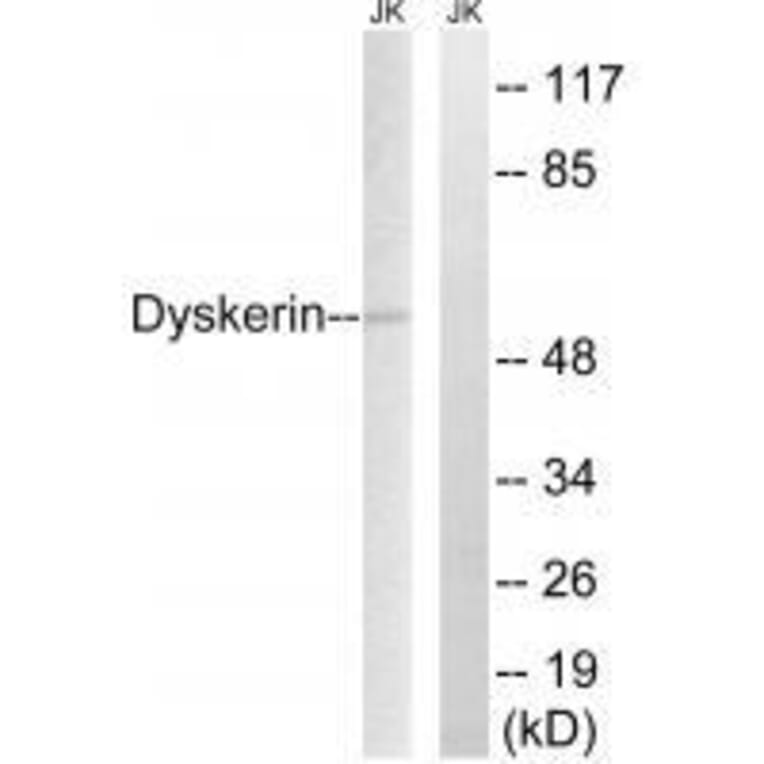 Western blot - Dyskerin Antibody from Signalway Antibody (33605) - Antibodies.com