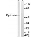 Western blot - Dyskerin Antibody from Signalway Antibody (33605) - Antibodies.com