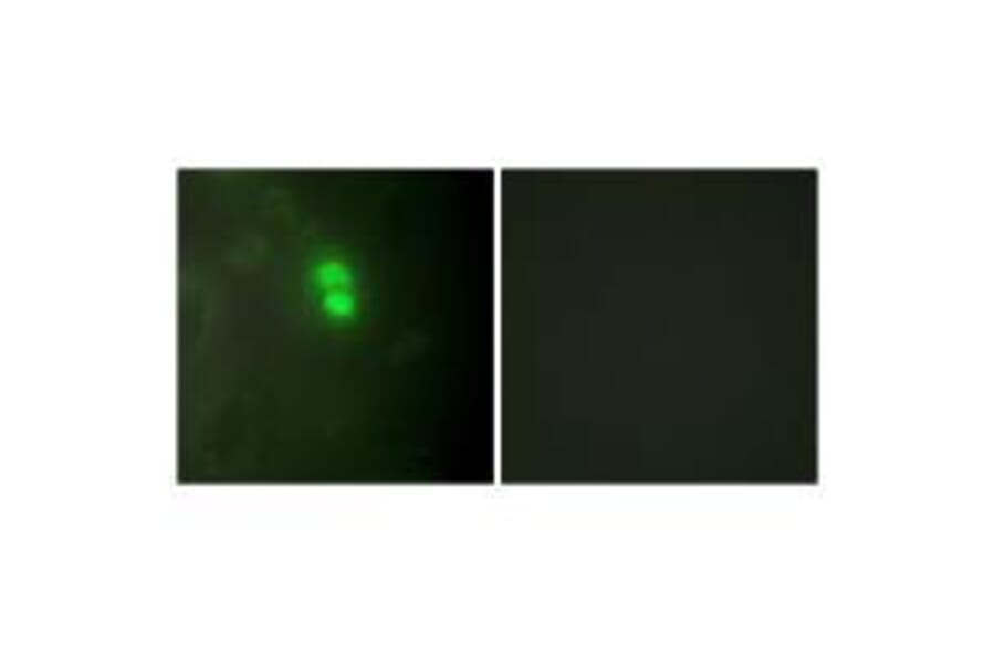 Immunofluorescence - Dyskerin Antibody from Signalway Antibody (33605) - Antibodies.com