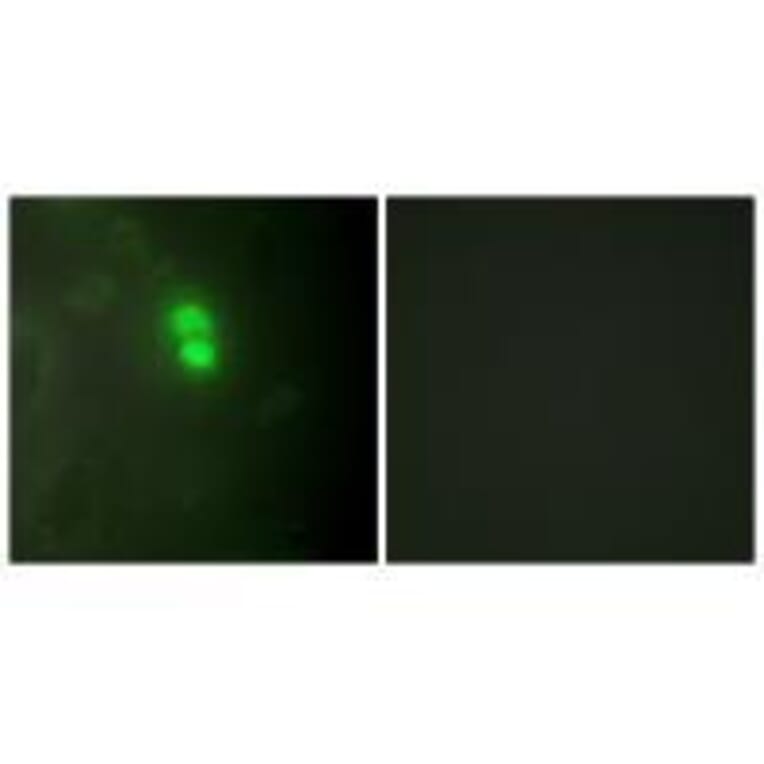 Immunofluorescence - Dyskerin Antibody from Signalway Antibody (33605) - Antibodies.com