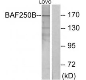 Western blot - BAF250B Antibody from Signalway Antibody (33978) - Antibodies.com