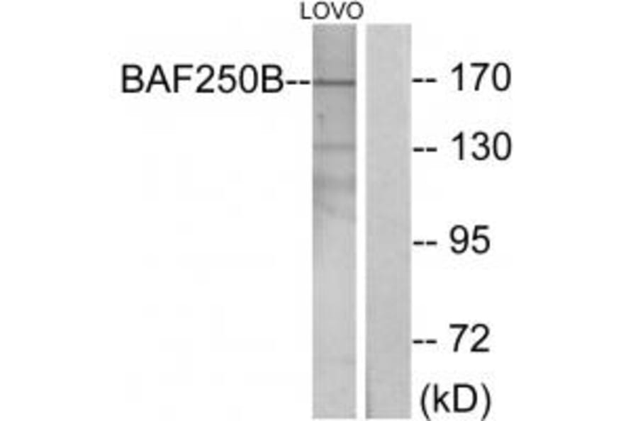 Western blot - BAF250B Antibody from Signalway Antibody (33978) - Antibodies.com