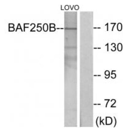 Western blot - BAF250B Antibody from Signalway Antibody (33978) - Antibodies.com