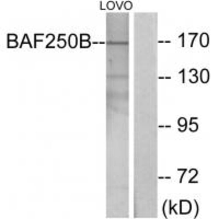 Western blot - BAF250B Antibody from Signalway Antibody (33978) - Antibodies.com