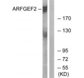 Western blot - ARFGEF2 Antibody from Signalway Antibody (34510) - Antibodies.com